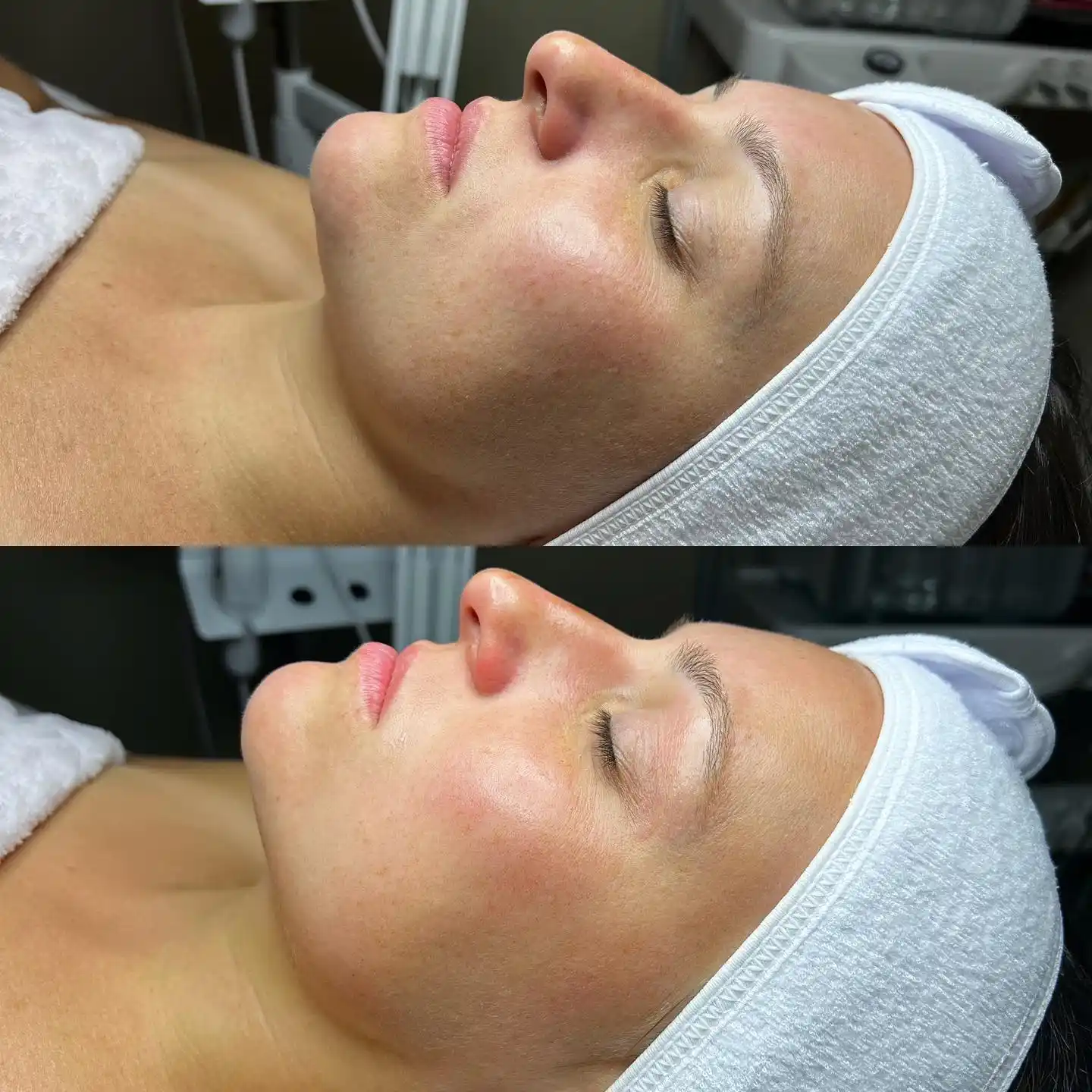 Close up of a face with a white headband and towel.