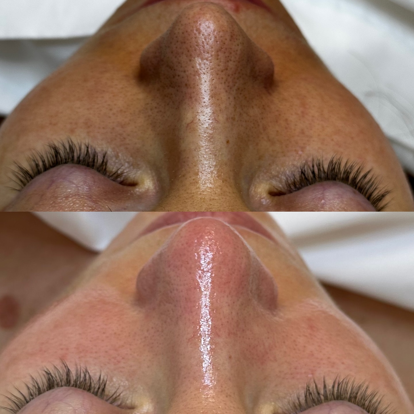 Close-up before and after of a nose with visible pores and lashes.