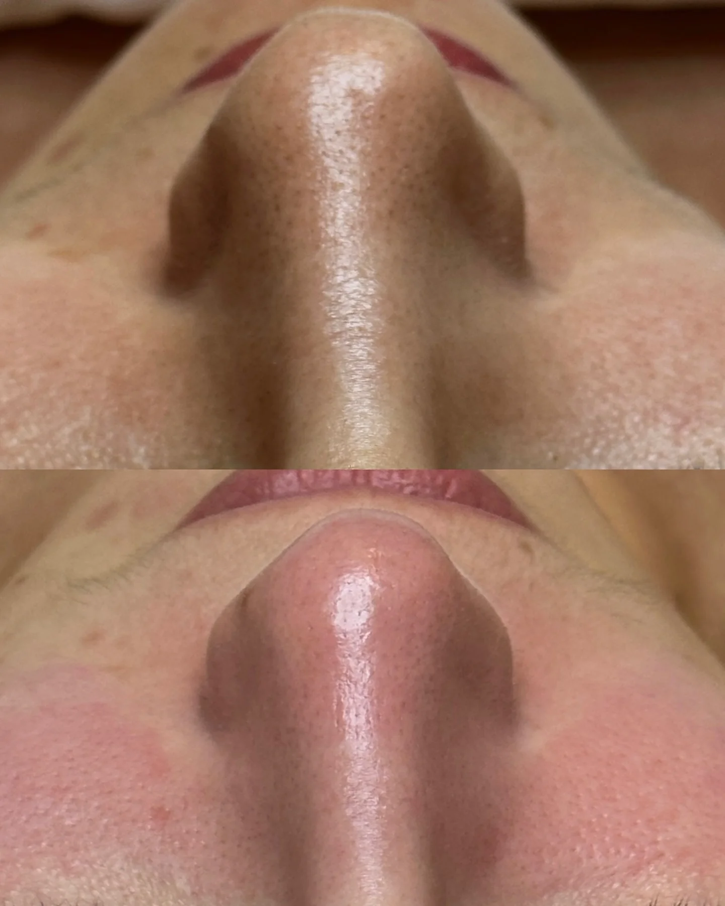 Close up of a nose showing pores and skin texture.