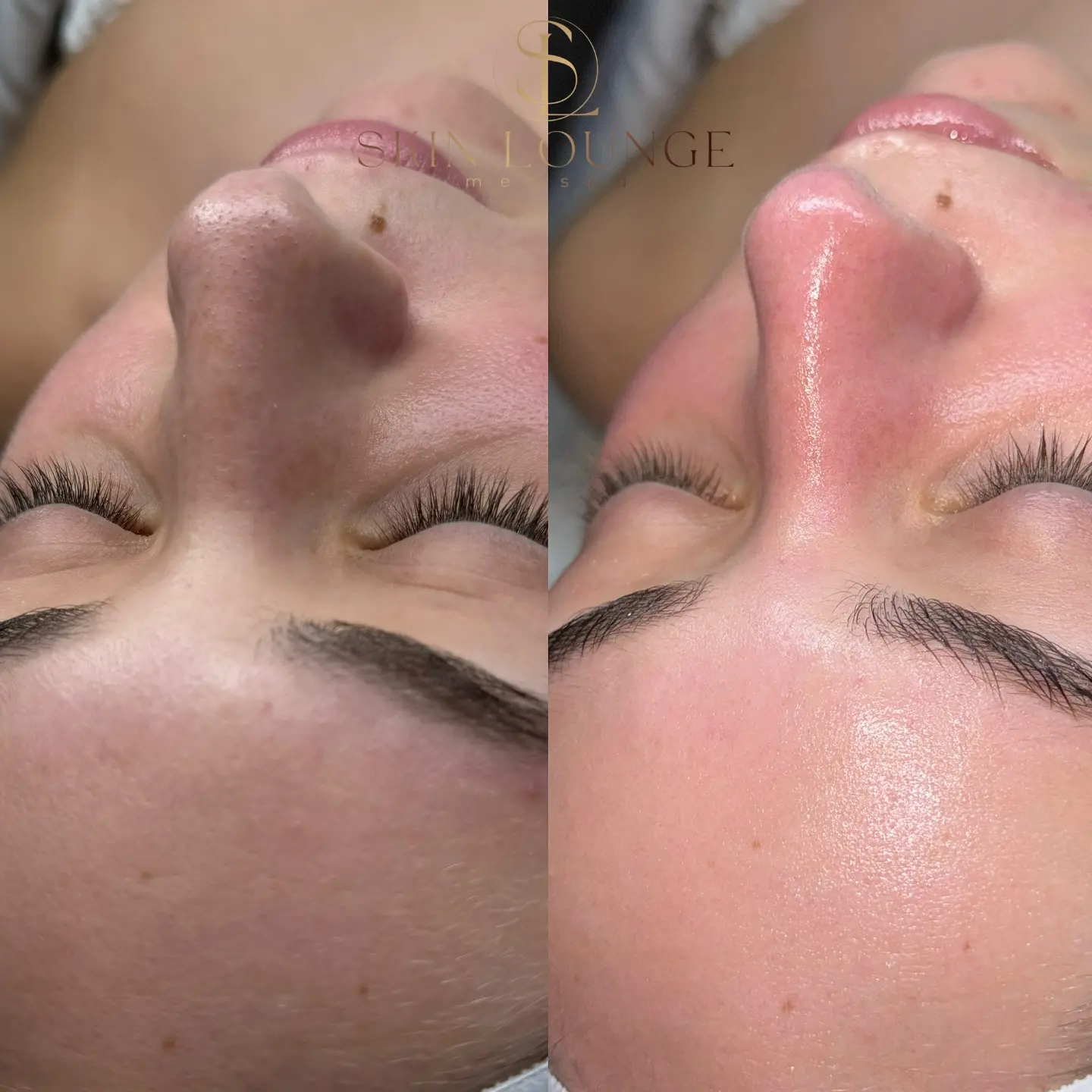Skin Lounge Med Spa SPA logo overlay on close-up of a face.
